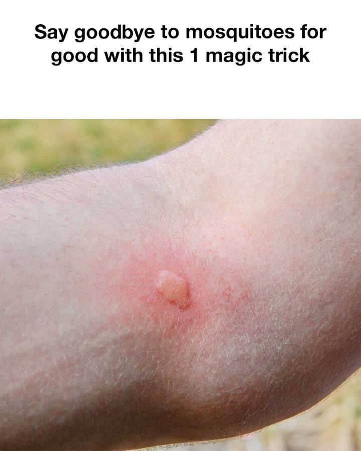 I Didn’t Realize This Would Work! A Simple Trick to Keep Mosquitoes Away