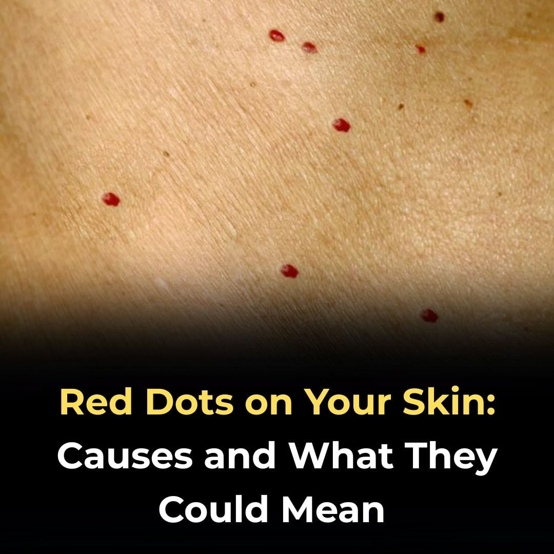 🔴 11 Common Reasons for Red Dots on Your Skin – When to Worry & When Not To
